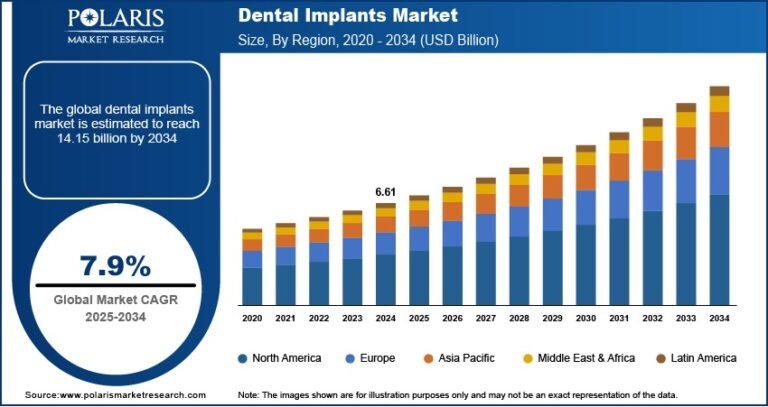 Dental Implants Market to Reach USD 14.15 Billion by 2034, Growing at a CAGR of 7.9%